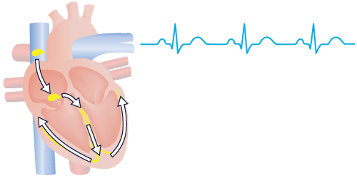 Normal Heartbeat