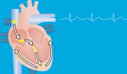 Normal Heartbeat