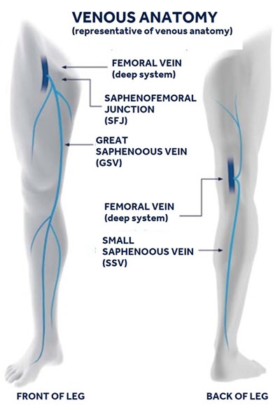 A front and back view of the venous anatomy of the legs.